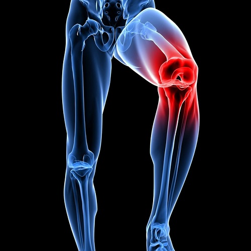 Sol diz kapağı ağrısı neden olur