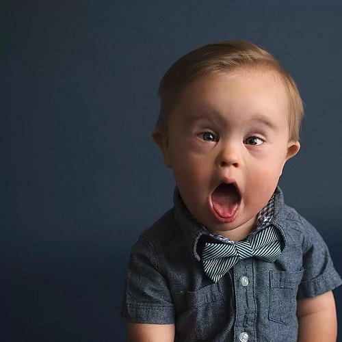 Down Sendromlu Kişilerin Neden 47 Kromozomu Vardır?