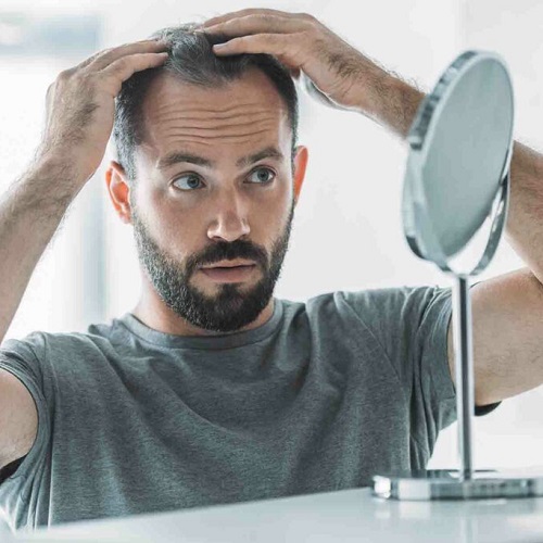 Saç Dökülür Sebebi Nedir